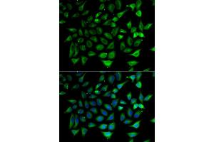 Immunofluorescence analysis of HeLa cells using SLC25A20 antibody (ABIN5974144). (SLC25A20 antibody)