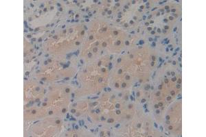 IHC-P analysis of kidney tissue, with DAB staining. (CDK2AP1 antibody  (AA 1-115))