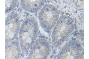 Detection of PFKM in Rat Colon Tissue using Polyclonal Antibody to Phosphofructokinase, Muscle (PFKM) (PFKM antibody  (AA 2-390))