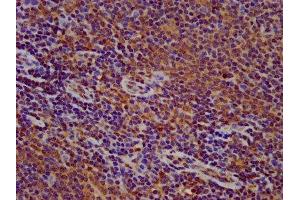 IHC image of ABIN7165598 diluted at 1:500 and staining in paraffin-embedded human lymph node tissue performed on a Leica BondTM system. (FLII antibody  (AA 577-729))