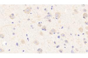 Detection of MXRA5 in Human Cerebrum Tissue using Polyclonal Antibody to Matrix Remodelling Associated Protein 5 (MXRA5) (Matrix Remodelling Associated Protein 5 (AA 2542-2828) antibody)