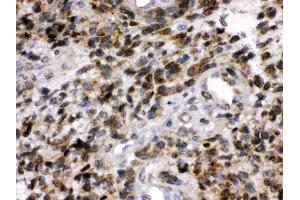 Anti- PGP9. (UCHL1 antibody  (C-Term))