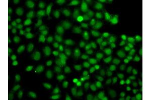 Immunofluorescence analysis of A549 cells using PIP5K1A antibody (ABIN6292233).