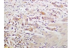 Immunohistochemistry (IHC) image for anti-Keratin 1 (KRT1) (AA 101-200) antibody (ABIN678488)