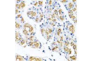 Immunohistochemistry of paraffin-embedded human gastric using FECH antibody at dilution of 1:100 (x40 lens). (FECH antibody)