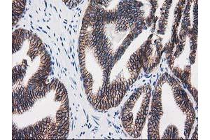Image no. 1 for anti-Catenin (Cadherin-Associated Protein), beta 1, 88kDa (CTNNB1) antibody (ABIN1496893) (CTNNB1 antibody)