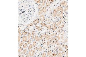 Immunohistochemical analysis of paraffin-embedded human kidney tissue using (ABIN651547 and ABIN2840295) performed on the Leica® BOND RXm. (SLC47A1 antibody  (C-Term))