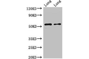 Western Blot Positive WB detected in: Rat lung tissue, Mouse lung tissue All lanes: HTR3A antibody at 2. (Serotonin Receptor 3A antibody  (AA 322-455))