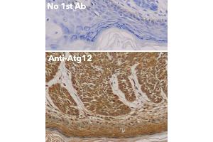 Immunohistochemistry (IHC) image for anti-Autophagy Related 12 (ATG12) (N-Term) antibody (ABIN6254241) (ATG12 antibody  (N-Term))
