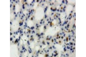 #VALUE! (Lipocalin 2 antibody  (AA 21-200))