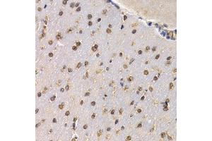 Immunohistochemistry of paraffin-embedded mouse brain using RAD1 antibody (ABIN6290854) at dilution of 1:200 (40x lens).