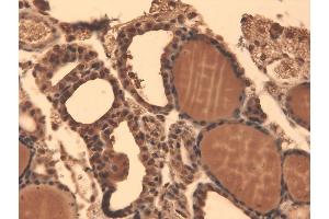 Immunohistochemistry analysis using Mouse Anti-Sodium Iodide Symporter Monoclonal Antibody, Clone 14F . (SLC5A5 antibody  (AA 468-643))