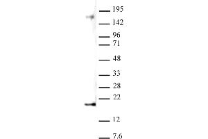 Histone H3 dimethyl Lys27 antibody (pAb) tested by Western blot. (Histone 3 antibody  (2meLys27))