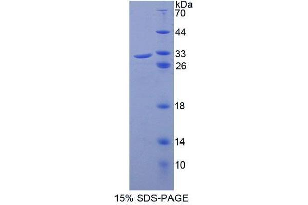 ABCB8 Protein (AA 468-717) (T7 tag,His tag)