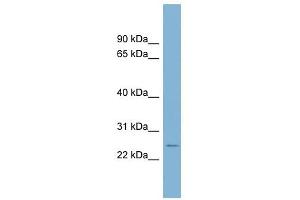 CD160 antibody used at 1 ug/ml to detect target protein. (CD160 antibody  (Middle Region))