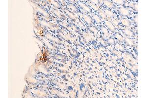 Immunohistochemistry (IHC) image for anti-Checkpoint Kinase 2 (CHEK2) (pThr68) antibody (ABIN6256592)