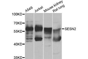 Western blot analysis of extracts of various cell lines, using SESN2 antibody (ABIN4905132) at 1:1000 dilution. (Sestrin 2 antibody)