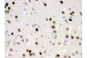 Anti- HDAC11 Picoband antibody,IHC(P) IHC(P): Mouse Brain Tissue (HDAC11 antibody  (N-Term))