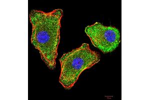 Immunocytochemistry (ICC) image for anti-Transthyretin (TTR) (AA 1-147) antibody (ABIN5875576) (TTR antibody  (AA 1-147))
