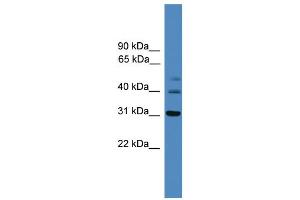 WB Suggested Anti-TRIB1  Antibody Titration: 0. (TRIB1 antibody  (C-Term))