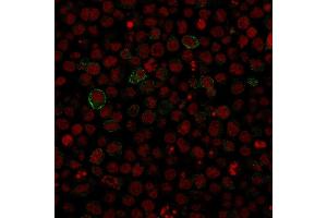 Immunofluorescence staining of Ramos cells using CD86 Mouse Monoclonal Antibody (SPM600). (CD86 antibody)