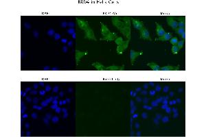 Sample Type :  HeLa   Primary Antibody Dilution:  4 ug/ml   Secondary Antibody :  Anti-rabbit Alexa 546   Secondary Antibody Dilution:  2 ug/ml   Gene Name :  BRD4 (BRD4 antibody  (C-Term))