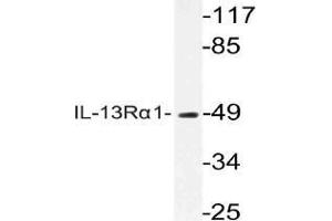 Western blot analysis of CD213a1 / IL13RA1 Antibody in extracts from COLOcells. (IL13 Receptor alpha 1 antibody)