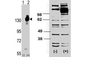 (LEFT) Western blot analysis of CSF1R (arrow) using rabbit CSF1R polyclonal antibody . (CSF1R antibody  (C-Term))