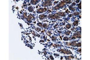 Immunohistochemical staining of paraffin-embedded Human breast tissue using anti-KHK mouse monoclonal antibody.