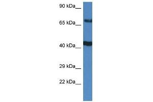 Western Blot showing TNIP1 antibody used at a concentration of 1 ug/ml against Hela Cell Lysate (TNIP1 antibody  (C-Term))