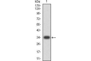 TNFRSF13C antibody  (AA 1-78)