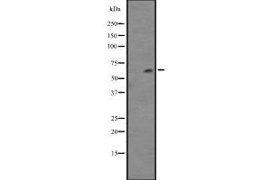 Western blot analysis of Cytochrome P450 4F12 expression in NCI-H460 cell line lysates ,The lane on the left is treated with the antigen-specific peptide. (CYP4F12 antibody)