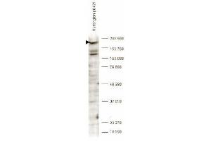 Western blot analysis is shown using anti-Huntingtin pS421 antibody to detect endogenous protein present in an unstimulated human PC-3 whole cell lysate (arrowhead).