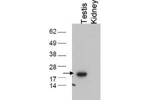 Image no. 1 for anti-Glutathione Peroxidase 4 (GPX4) (C-Term) antibody (ABIN401375) (GPX4 antibody  (C-Term))