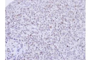 IHC-P Image Immunohistochemical analysis of paraffin-embedded H1299 xenograft , using PCNP, antibody at 1:500 dilution. (PCNP antibody  (N-Term))