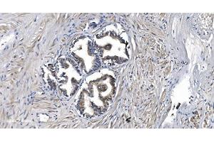 IHC analysis of STIL/SIL using anti-STIL/SIL antibody (ABIN7599923). (STIL antibody  (AA 13-1287))