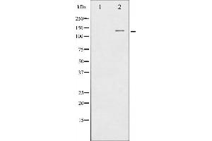 Western blot analysis of CBL expression in Na2VO3 treated HepG2 whole cell lysates,The lane on the left is treated with the antigen-specific peptide. (CBL antibody  (Internal Region))