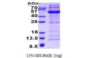 Image no. 1 for tyrosyl-DNA phosphodiesterase 2 (TDP2) protein (His tag) (ABIN7280202) (TDP2 Protein (His tag))