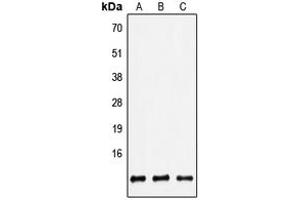 Western blot analysis of Defensin beta 2 expression in HEK293T (A), Raw264. (beta 2 Defensin antibody  (Center))