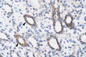 Image no. 2 for anti-SRY (Sex Determining Region Y)-Box 10 (SOX10) (AA 191-240) antibody (ABIN6746058) (SOX10 antibody  (AA 191-240))