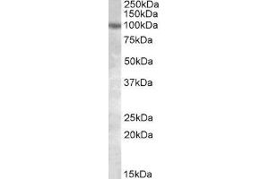 ABIN2564625 (1µg/ml) staining of HeLa lysate (35µg protein in RIPA buffer). (PKD2 antibody  (Internal Region))