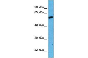 Host:  Mouse  Target Name:  DES  Sample Tissue:  Mouse Testis  Antibody Dilution:  1ug/ml (Desmin antibody  (Middle Region))