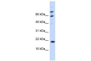 Western Blotting (WB) image for anti-BRWD1-AS2 antibody (ABIN2458959) (BRWD1-AS2 antibody)
