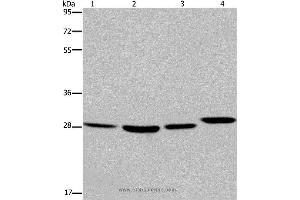 Western blot analysis of 293T and LoVo cell, mouse skin tissue and A172 cell, using ETV7 Polyclonal Antibody at dilution of 1:850 (ETV7 antibody)