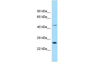 WB Suggested Anti-EIF4E1B Antibody Titration: 1.