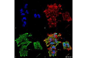 Immunocytochemistry/Immunofluorescence analysis using Mouse Anti-Alpha B Crystallin Monoclonal Antibody, Clone 3A10. (CRYAB antibody  (HRP))