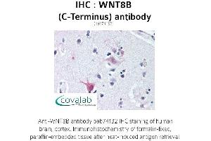 Image no. 1 for anti-Wingless-Type MMTV Integration Site Family, Member 8B (WNT8B) (C-Term) antibody (ABIN1740841) (WNT8B antibody  (C-Term))