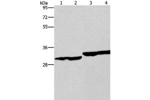 Western Blot analysis of Human endometrial carcinoma and colon cancer tissue, Human fetal liver tissue and PC3 cell using DECR1 Polyclonal Antibody at dilution of 1:300 (DECR1 antibody)