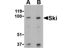 Western Blotting (WB) image for anti-SKI Proto-Oncogene (SKI) (N-Term) antibody (ABIN1031573) (SKI antibody  (N-Term))