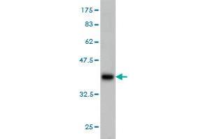 Western Blot detection against Immunogen (37. (GUCY2D antibody  (AA 521-630))